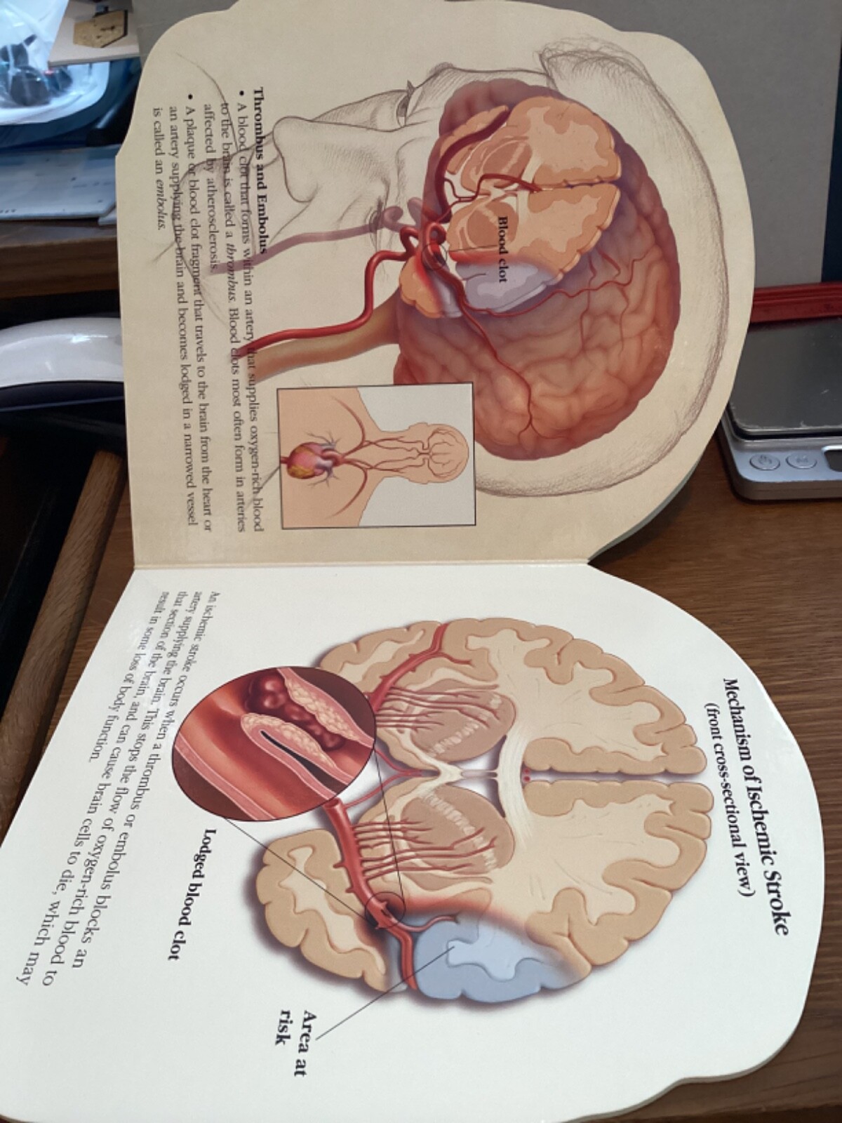 PLAVIX STROKE A LEARNING AND RESOURCE GUIDE CARDBOARD BOOK DRUG REP PROMO