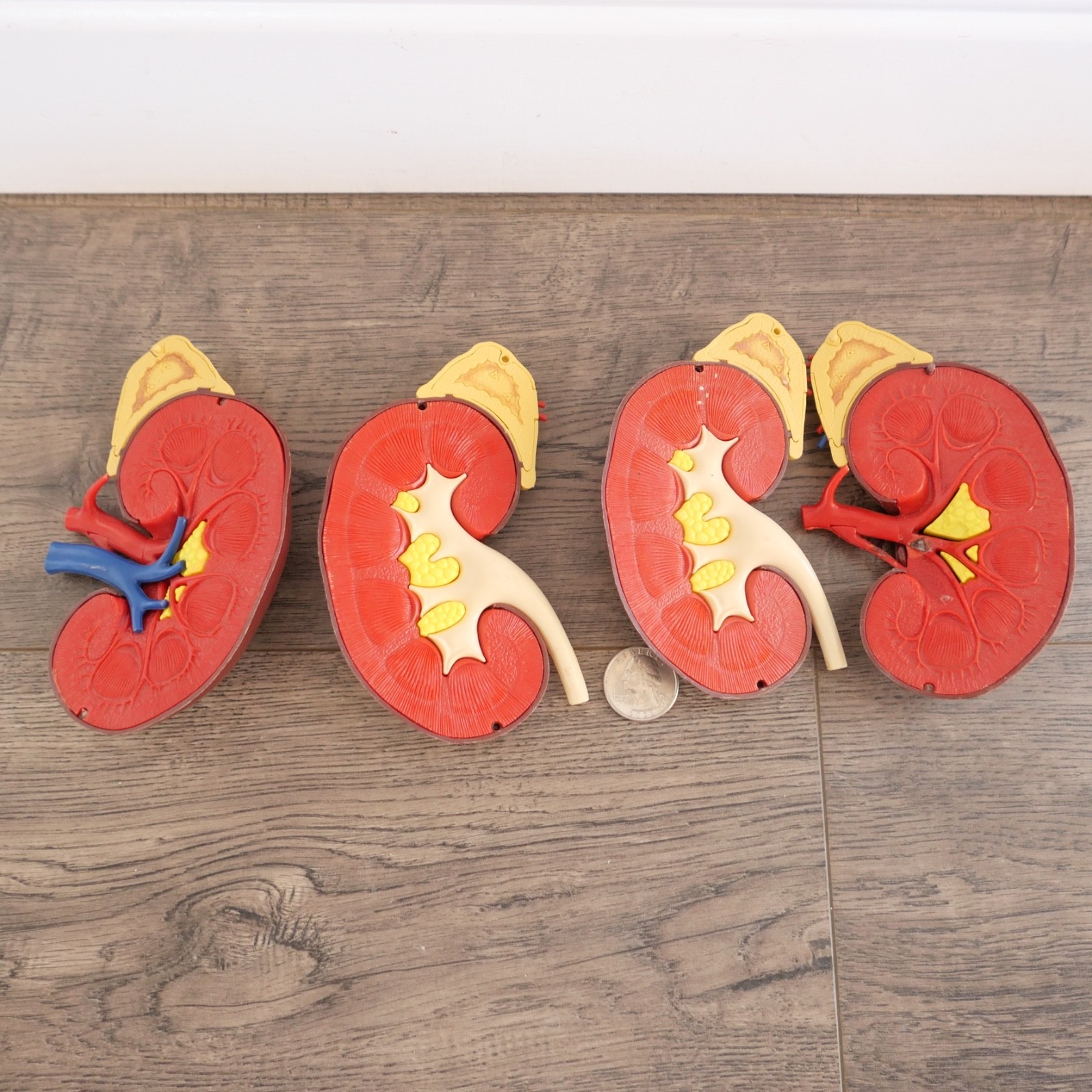 Vintage 1961 Merck & Co Pharmaceuticals Plastic Model Human Kidney Organ 5″ set