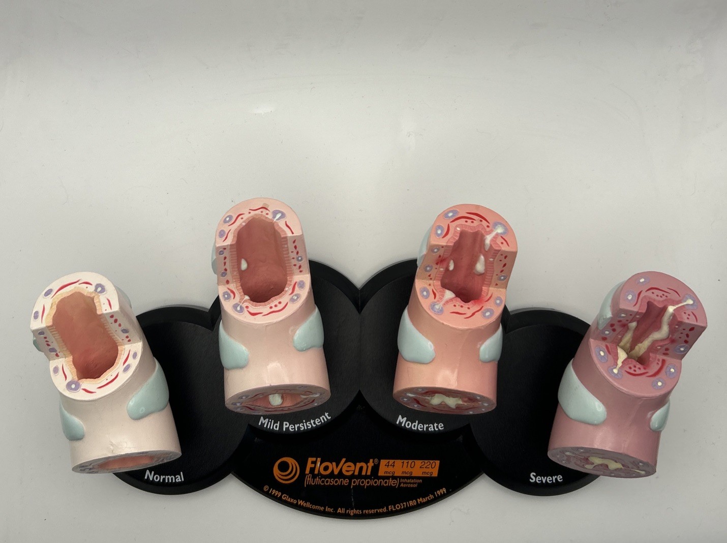 Flovent Asthma Trachea Bronchus Anatomical Pathology Model Pharmadesign 1999
