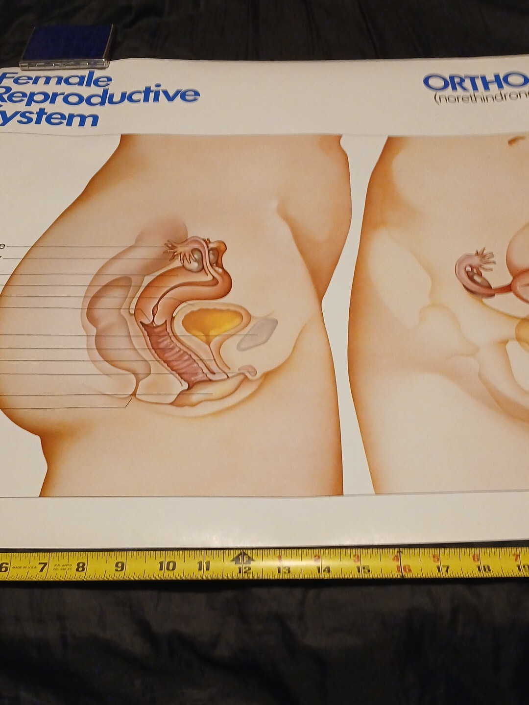 Vinatge 1986 Female Reproductive System ORTHO-NOVUM 777 20×34 Poster ORTHO…