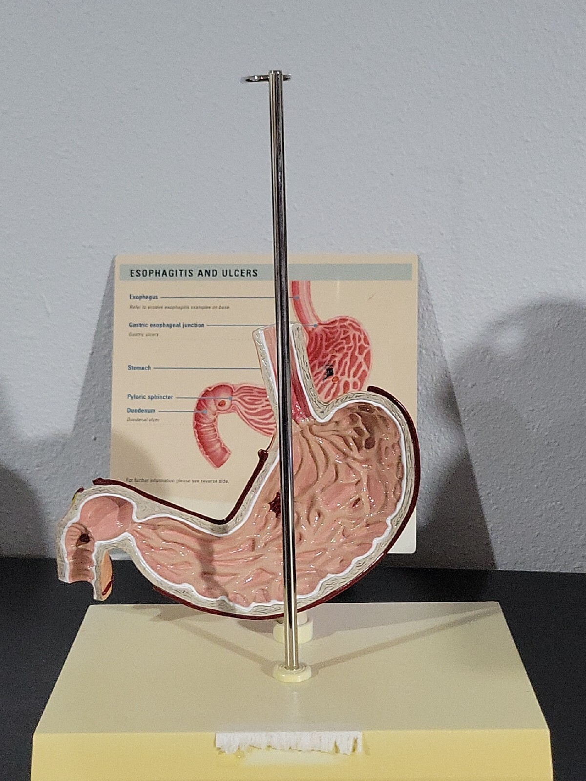Vtg Prevacid & Zelnorm Doctor Pharmaceutical Display Esophagitis & Ulcers