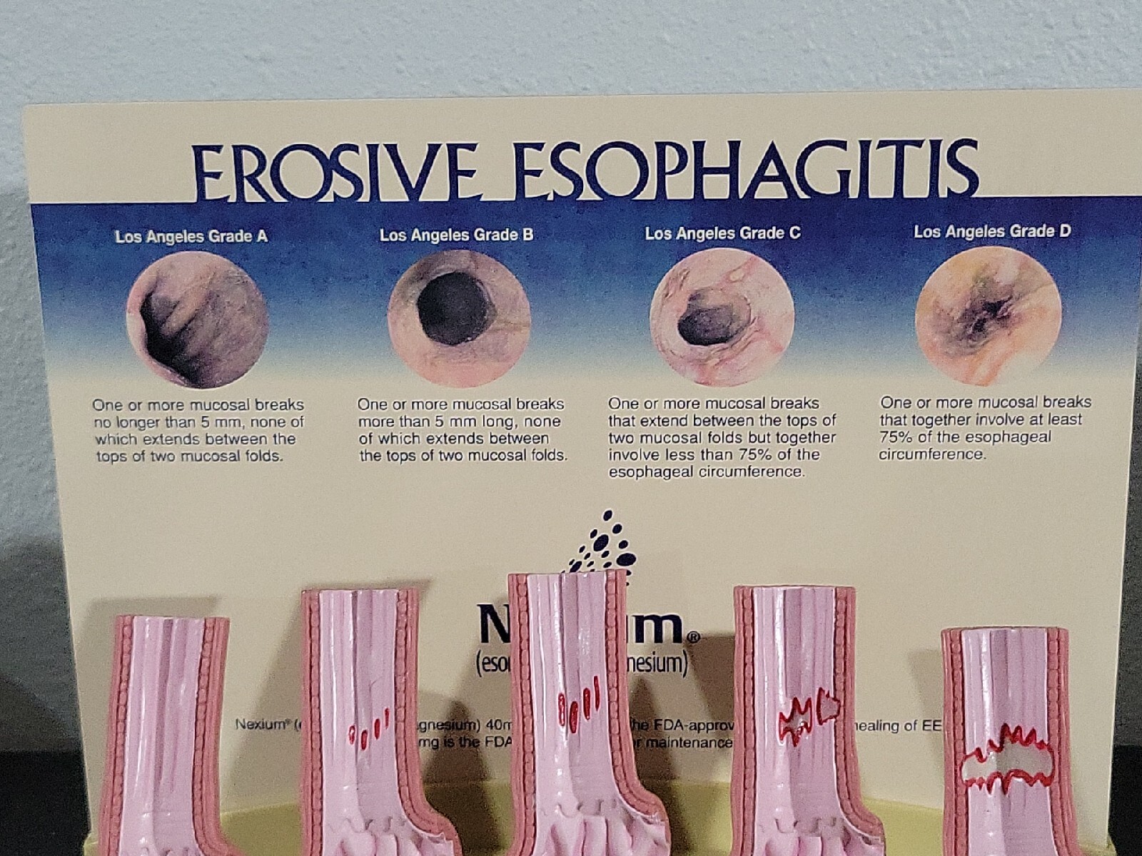 Vintage Nexium Doctor Pharmaceutical Display Erosive Esophagitis