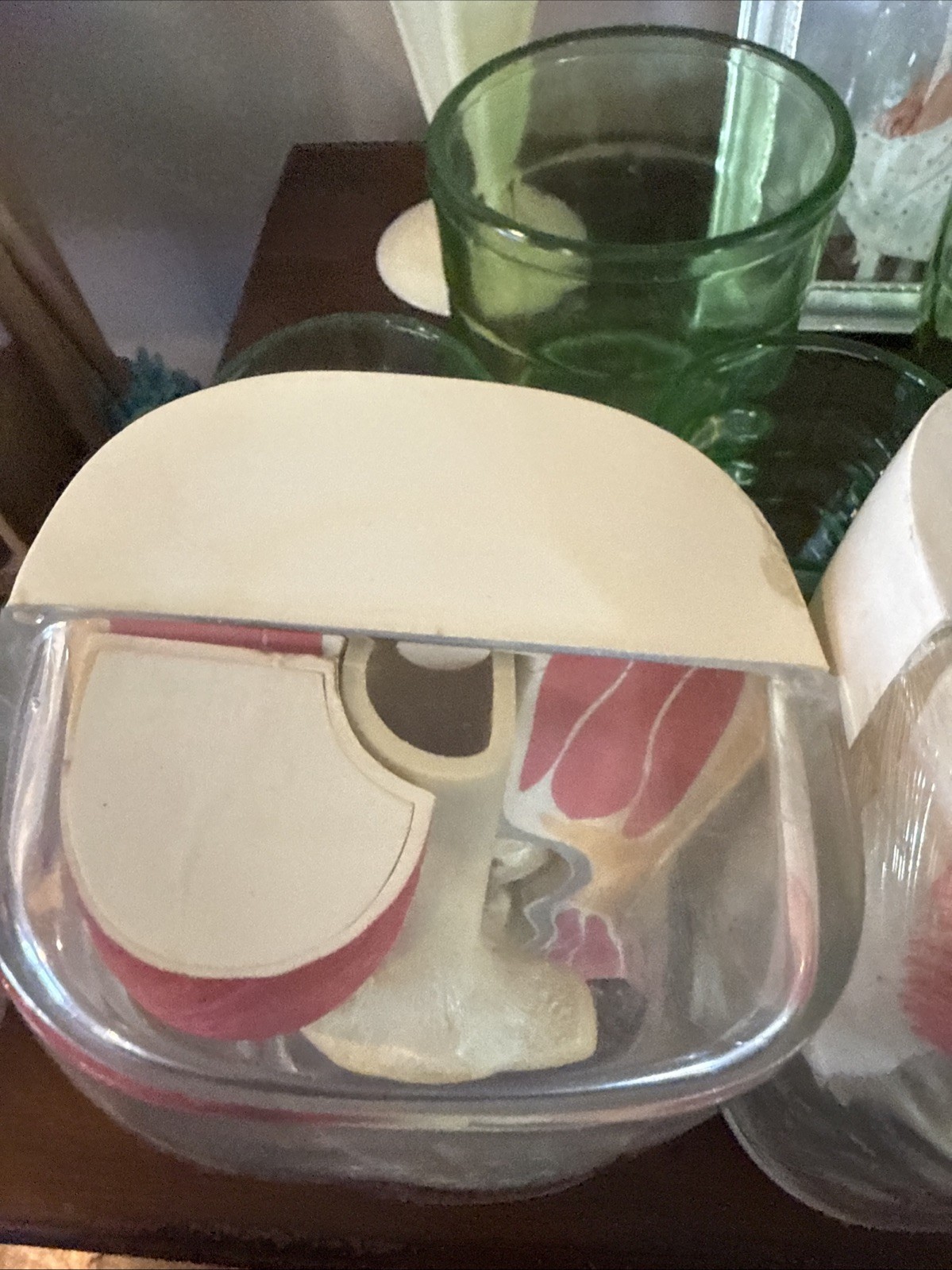 Vintage 1962 Human Knee Merck & Co Medical Anatomical Model Set Of 2 One Price