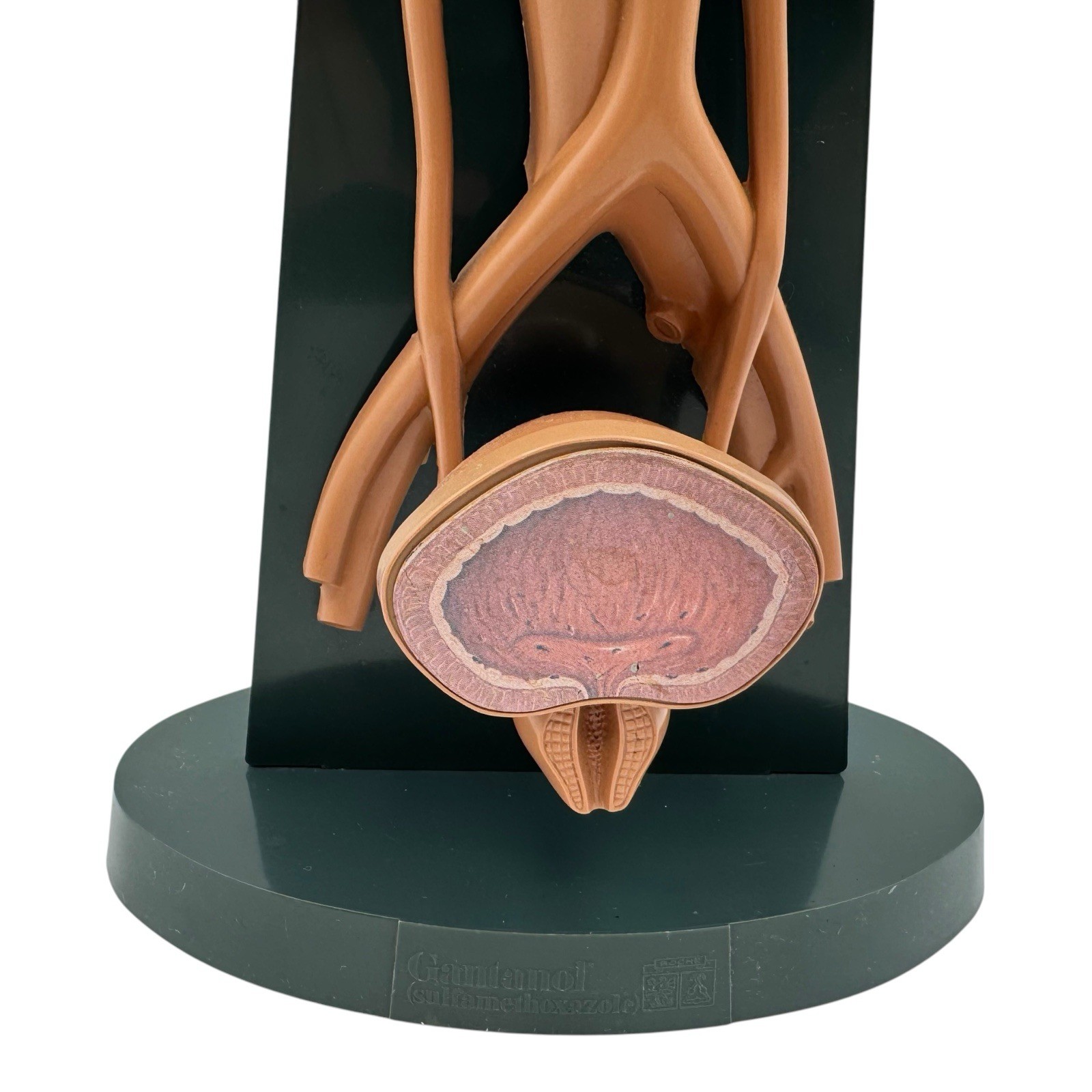 URINARY TRACT ANATOMY MODEL Medical DISPLAY Pharmaceutical RX Advertising Roche