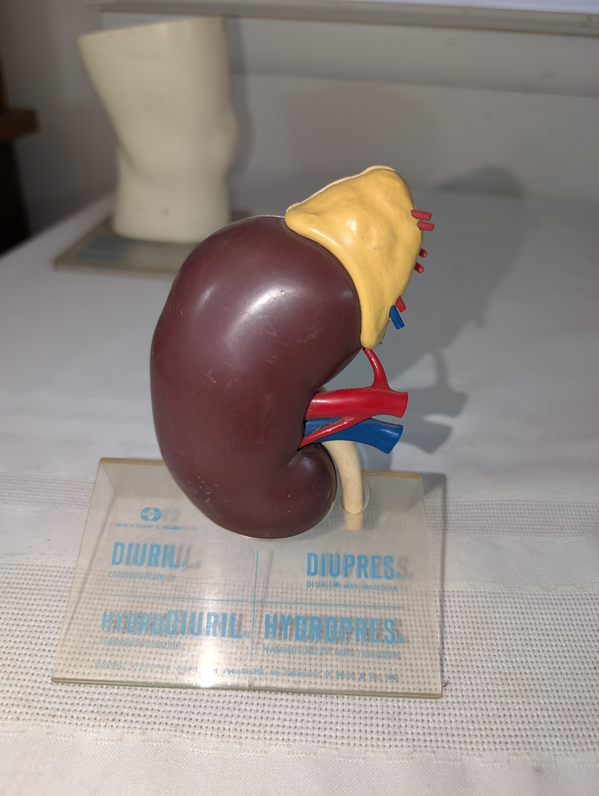 1960s Merck Pharmaceutical Advertising Model “Hydrodiuril Hydropres” Model