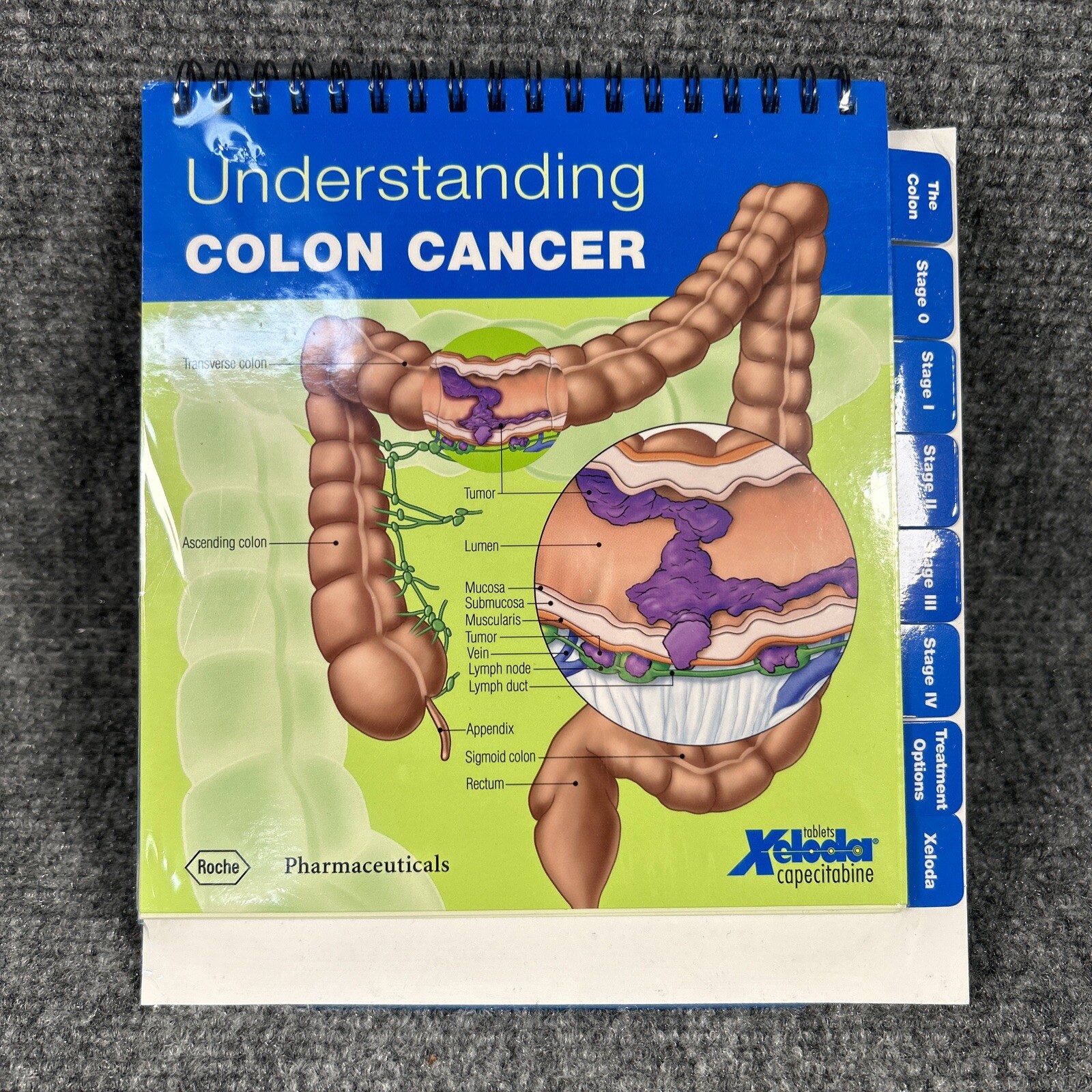 Colon Cancer Anatomical Anatomy Model Chart Display Roche Pharmaceutical Xeloda