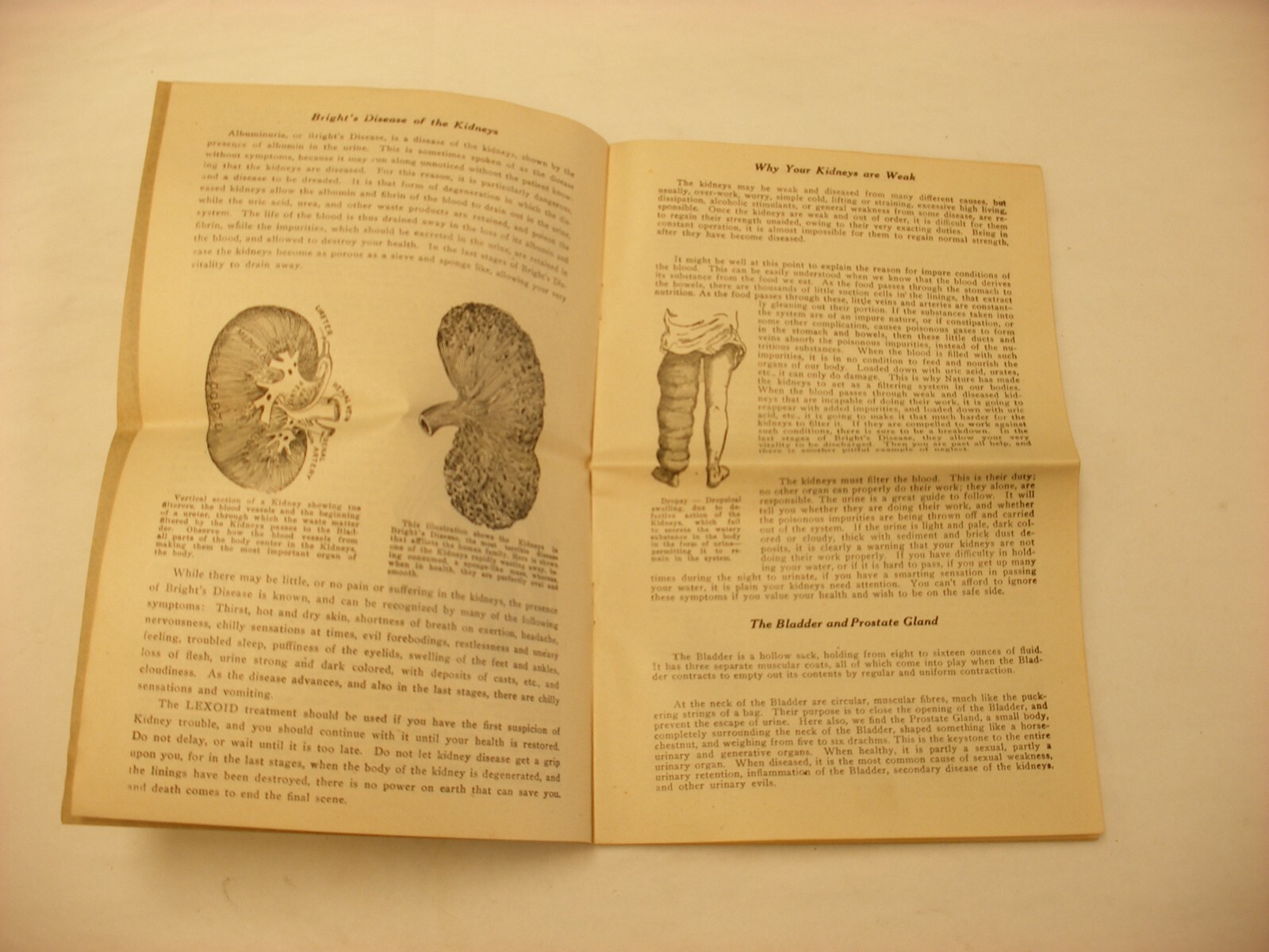Vtg Medical & Pharmacy Quack Cure – Lexoid Co. Clevland OH