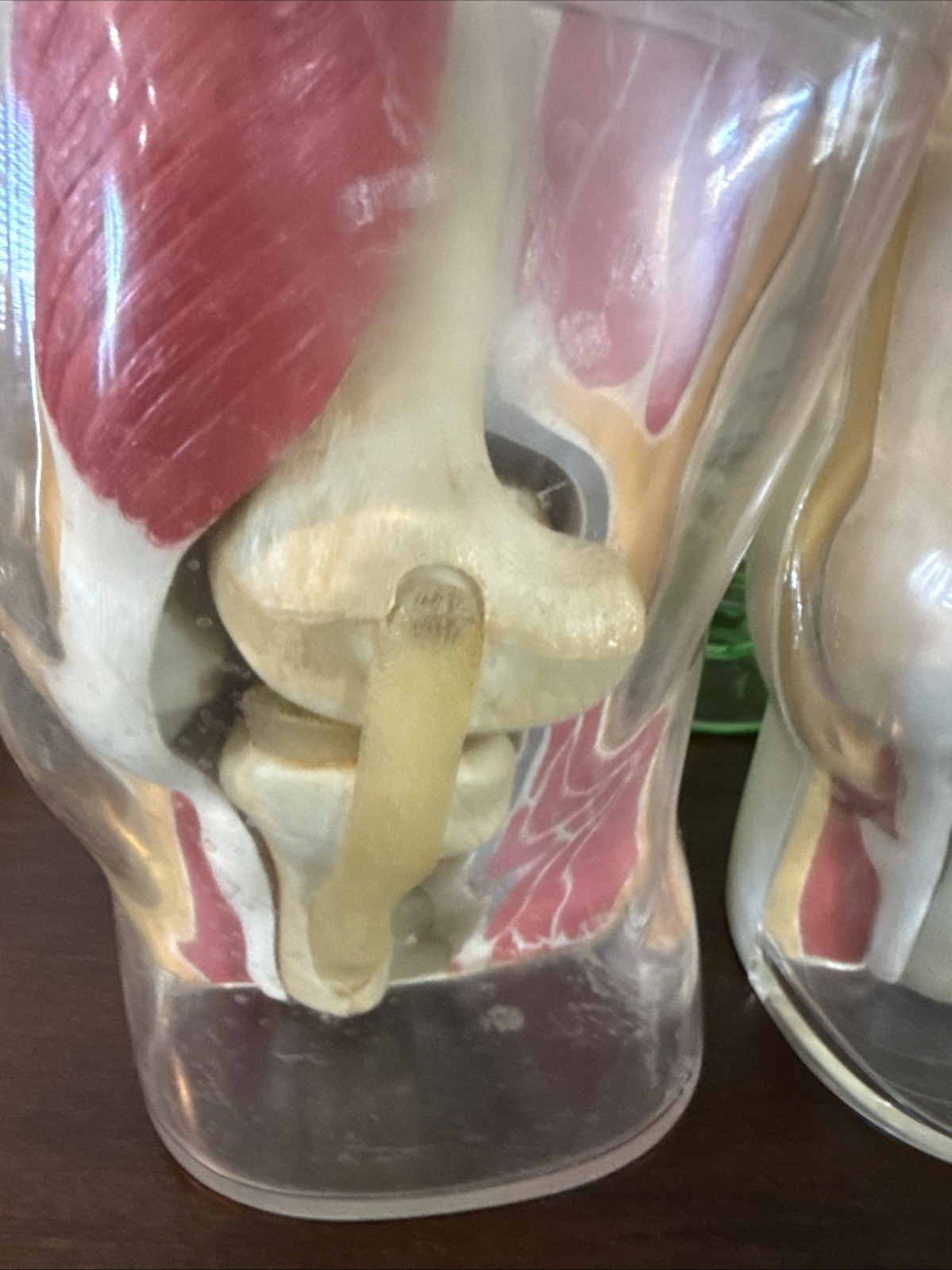 Vintage 1962 Human Knee Merck & Co Medical Anatomical Model Set Of 2 One Price