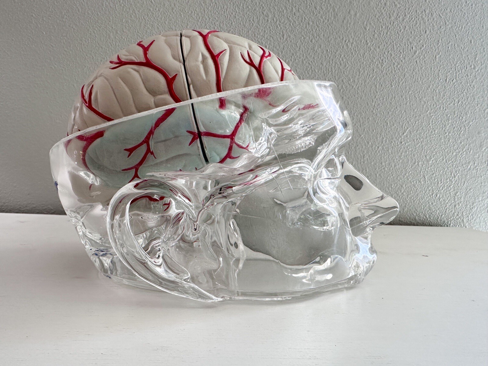 UCB Pharma Lucite Head Skull Brain Model Medical Pharmaceutical Science Display