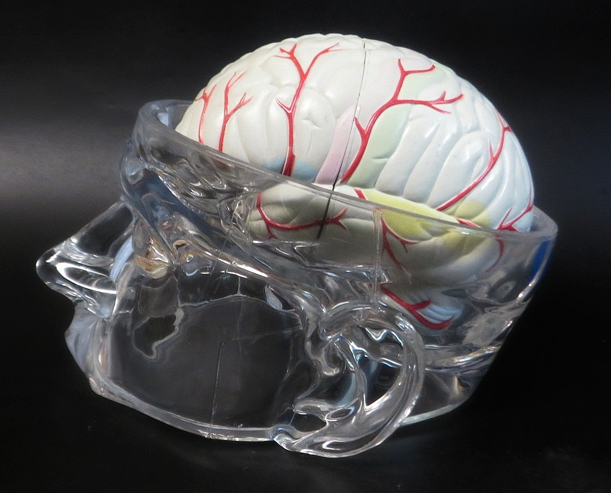 Head Skull Brain Model Seroquel Medical Pharmaceutical Lucite Medical Display