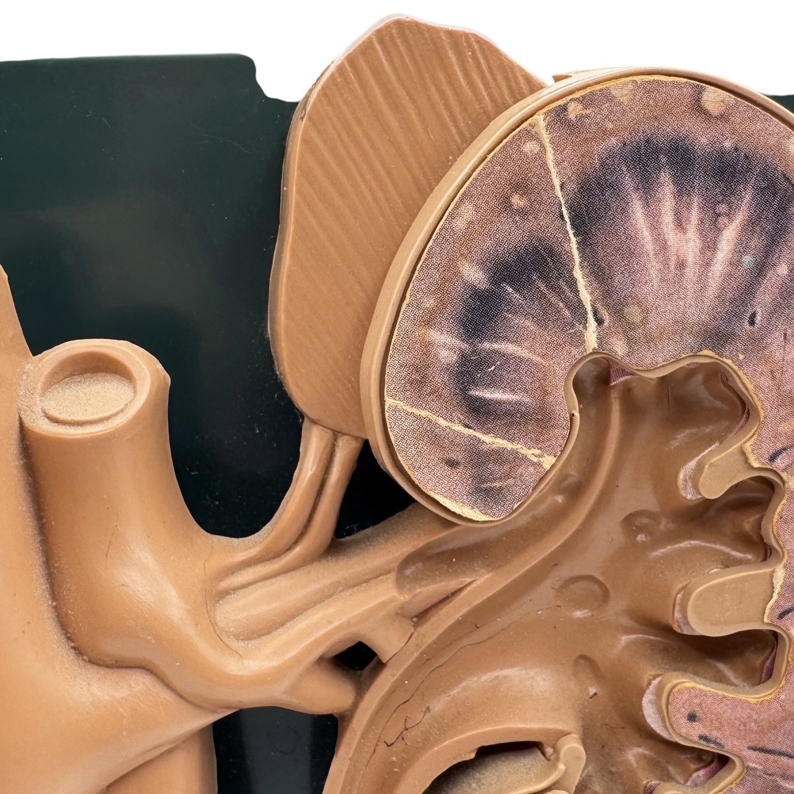 URINARY TRACT ANATOMY MODEL Medical DISPLAY Pharmaceutical RX Advertising Roche