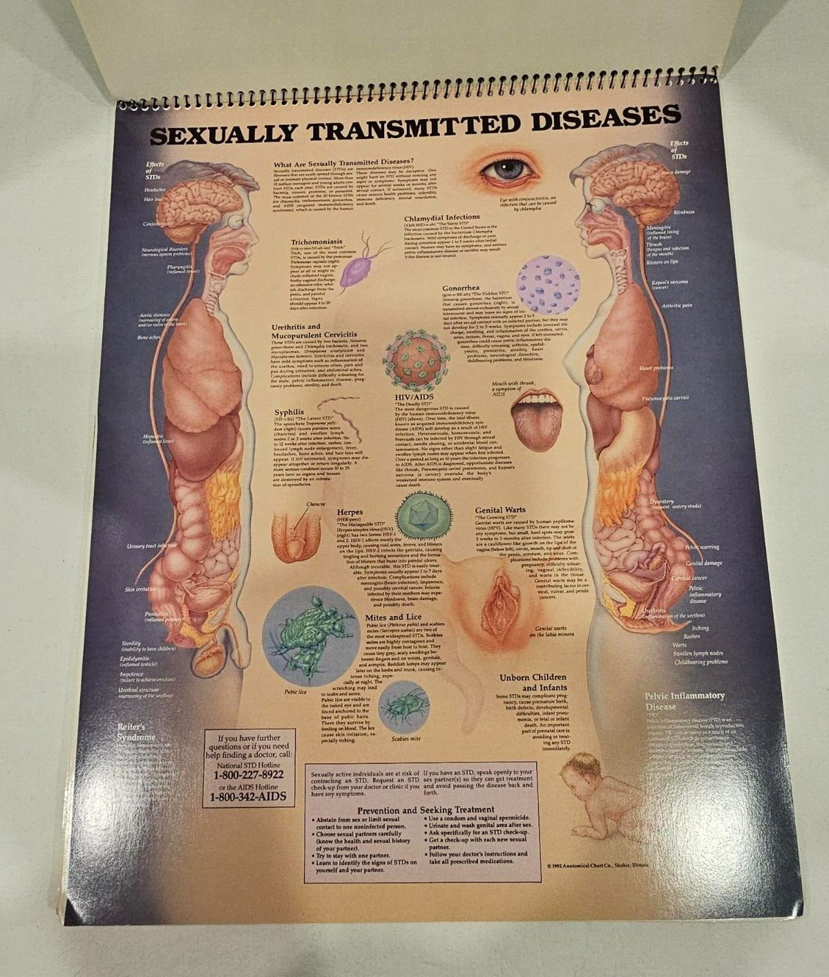 Vintage BURROUGHS WELLCOME CO Zovirax Anatomic Atlas Free Standing 1994