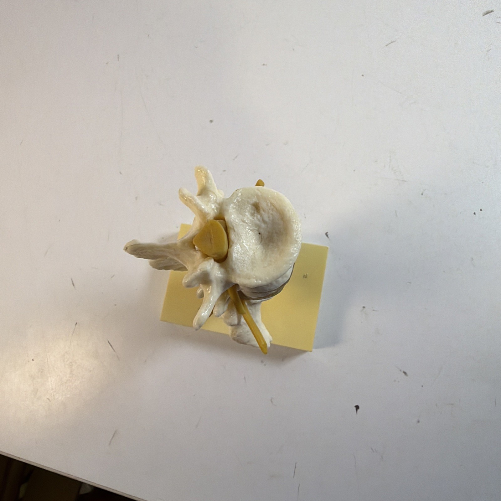 VINTAGE GEIGY Lumbar Spine Anatomical Model Medical School Doctor Display