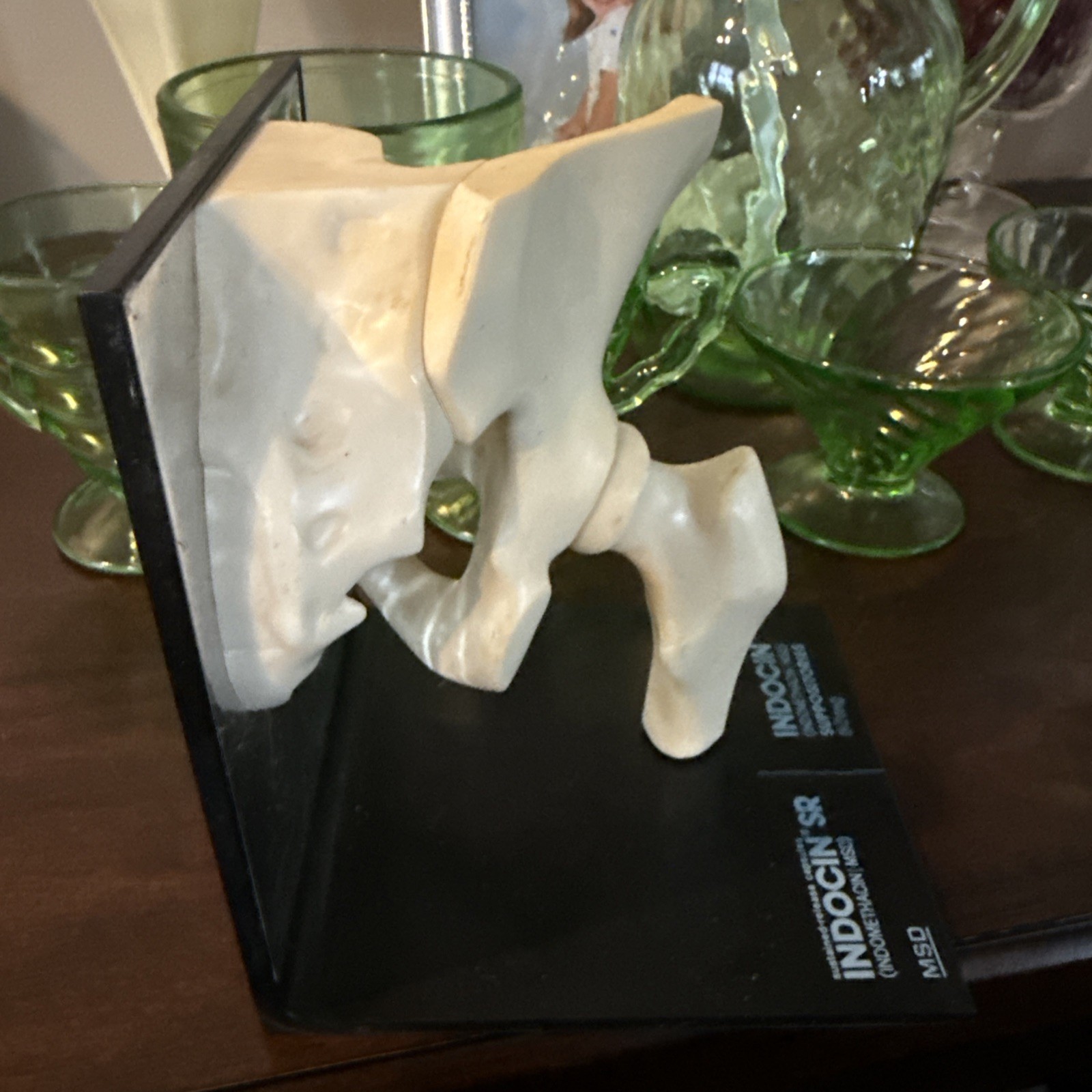 Vintage 1980’s Merck Indocin Human Hip Anatomically Correct Excellent Look