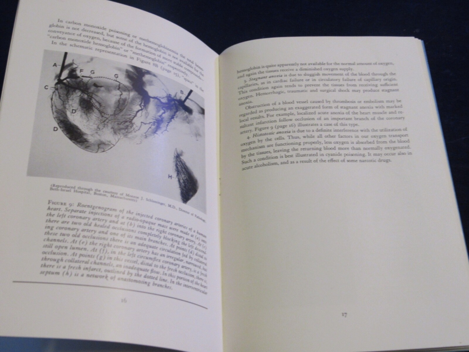 1950’s Medical 28pg booklet Physiology of Anoxia Inhalation Therapy B191