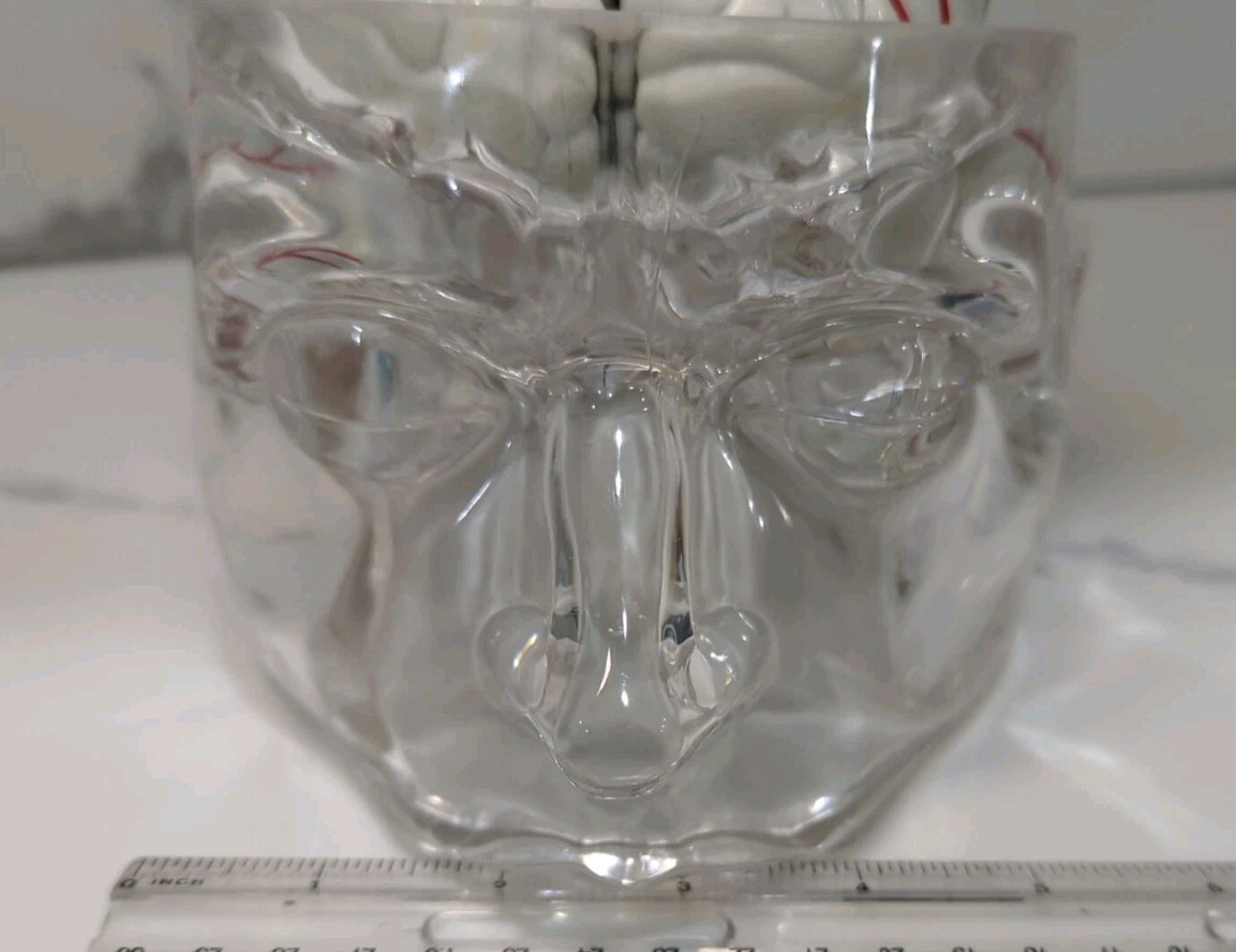 Gliadel Human Brain Anatomy Model w/ Clear Skull PharmaDesign Medical Display