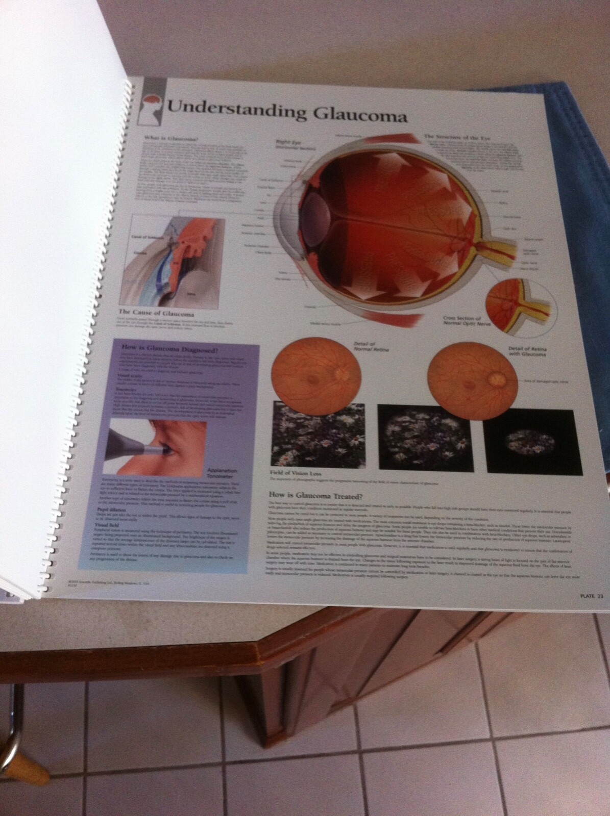 Drug rep 14″X11″ spiral bound Anatomic Charts