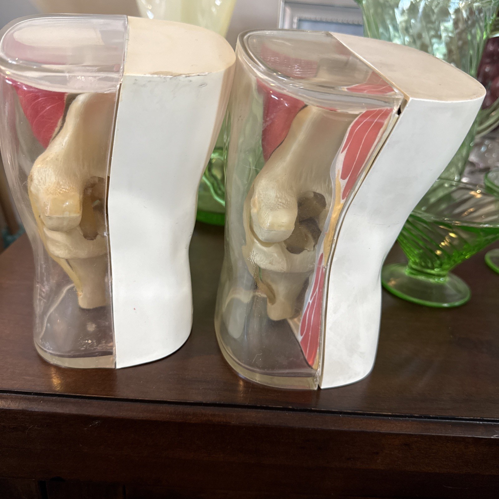 Vintage 1962 Human Knee Merck & Co Medical Anatomical Model Set Of 2 One Price