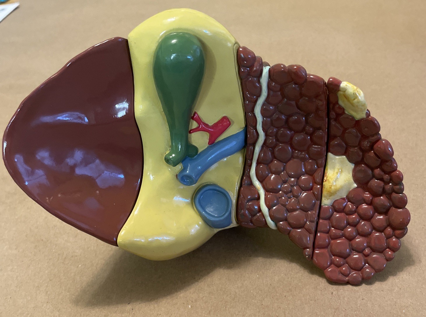 Diseased Liver Anatomical Teaching Model Schering Oncology Biotech Pharmadesign
