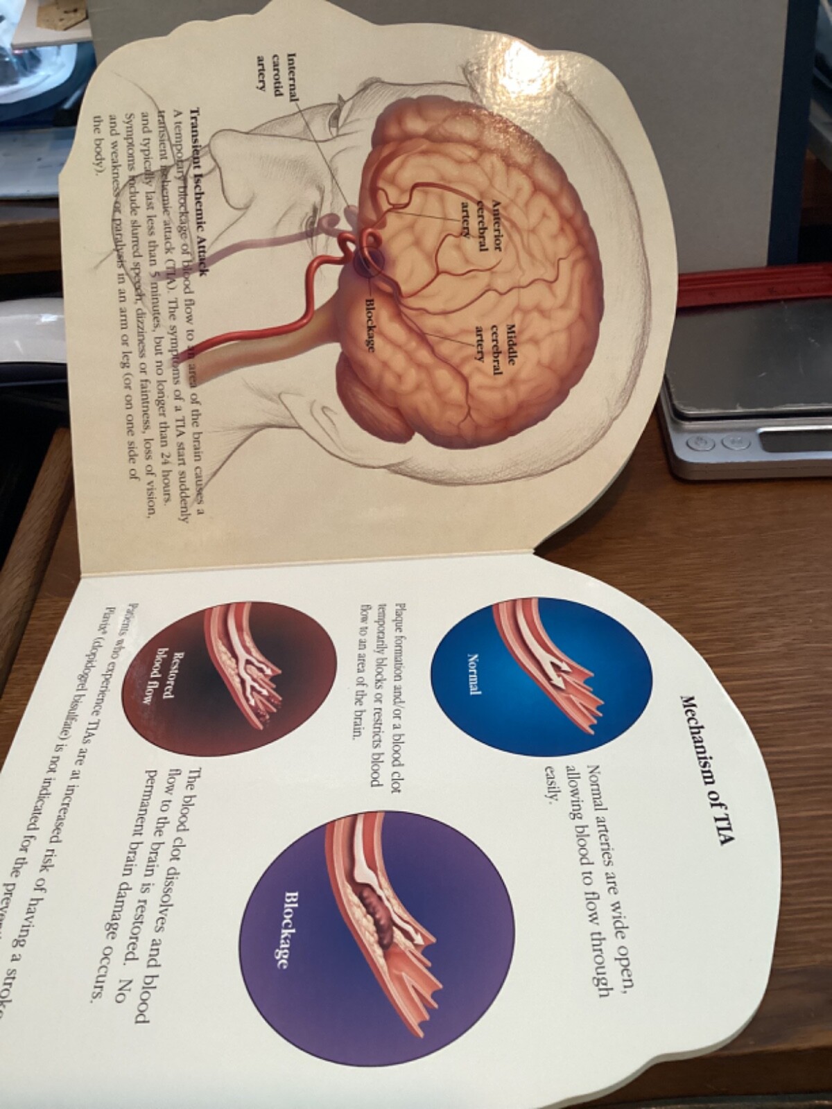PLAVIX STROKE A LEARNING AND RESOURCE GUIDE CARDBOARD BOOK DRUG REP PROMO