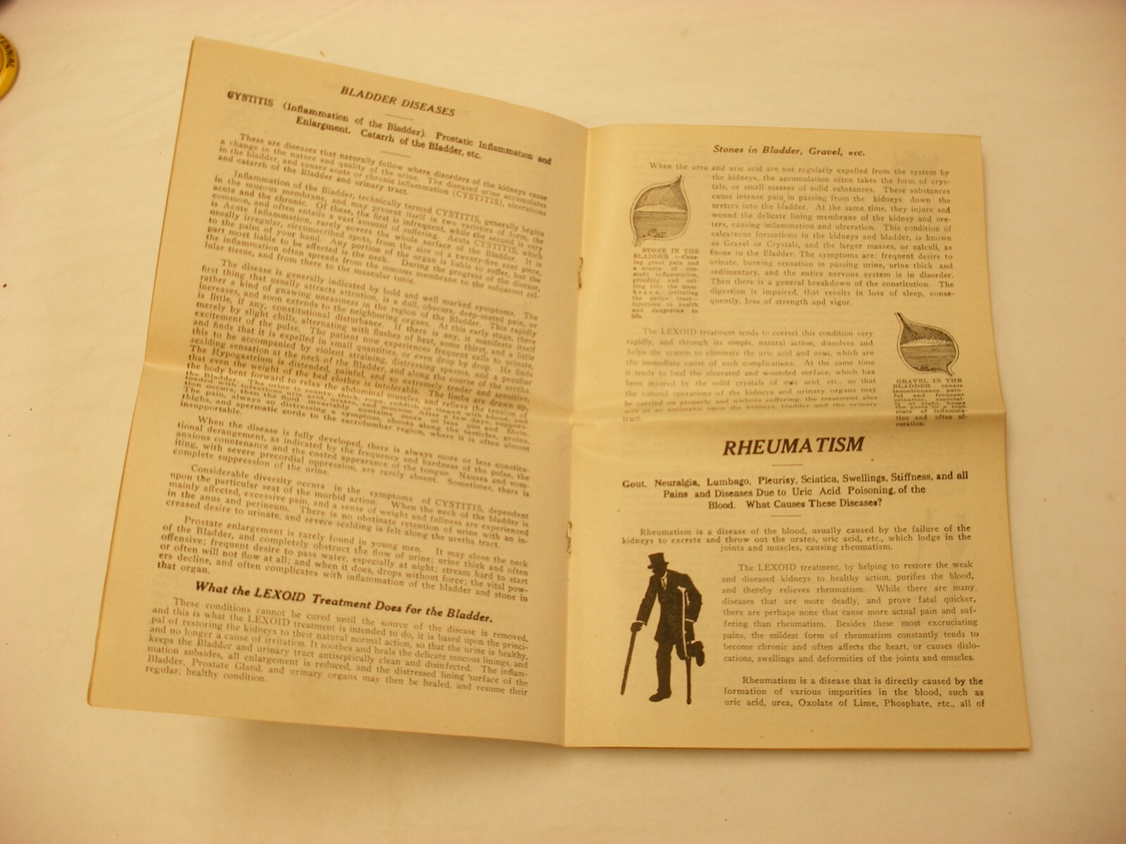 Vtg Medical & Pharmacy Quack Cure – Lexoid Co. Clevland OH