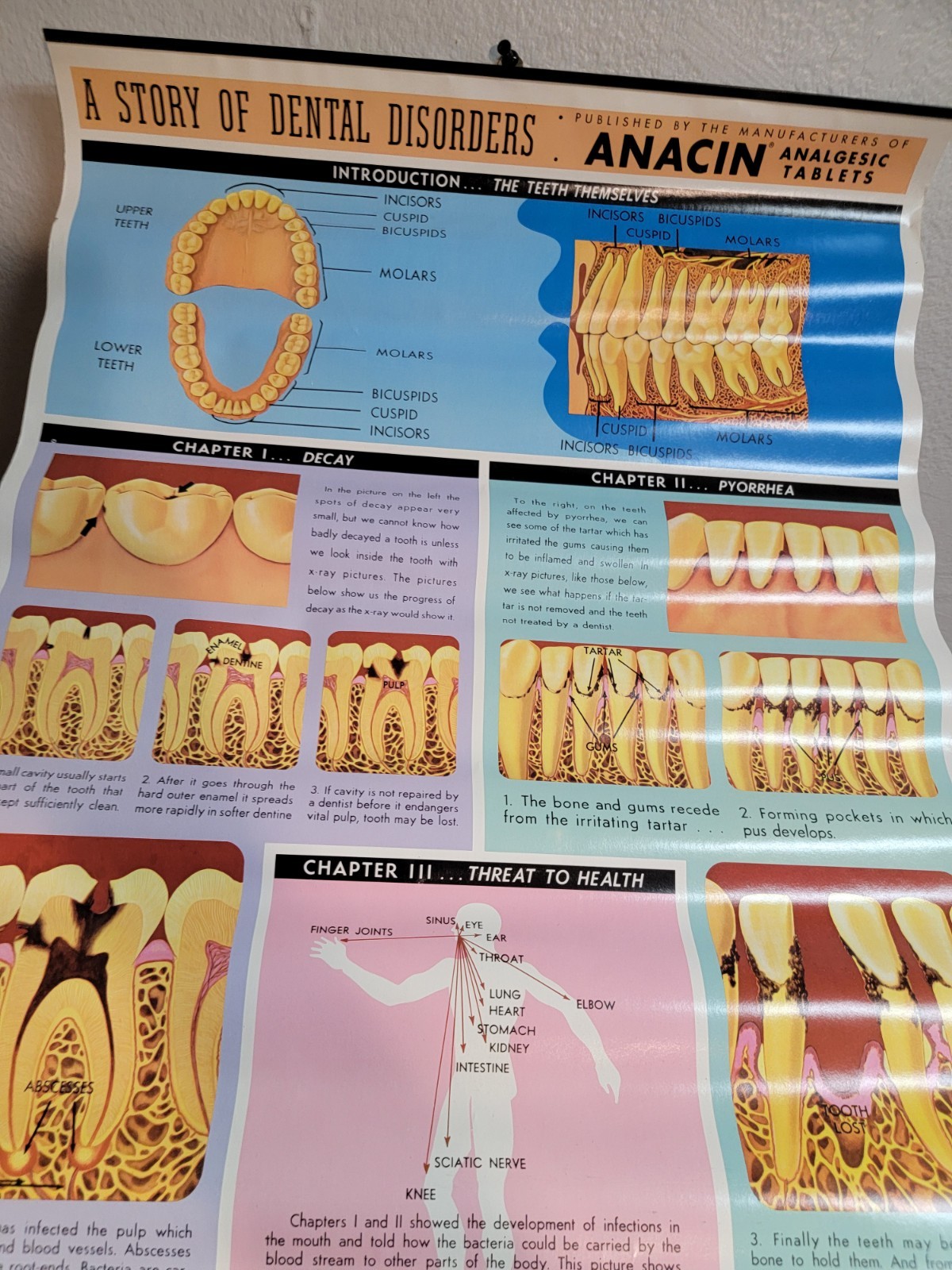 Vintage ANACIN Tablets WHITEHALL Laboratories ADVERTISING Dentist DENTAL POSTER