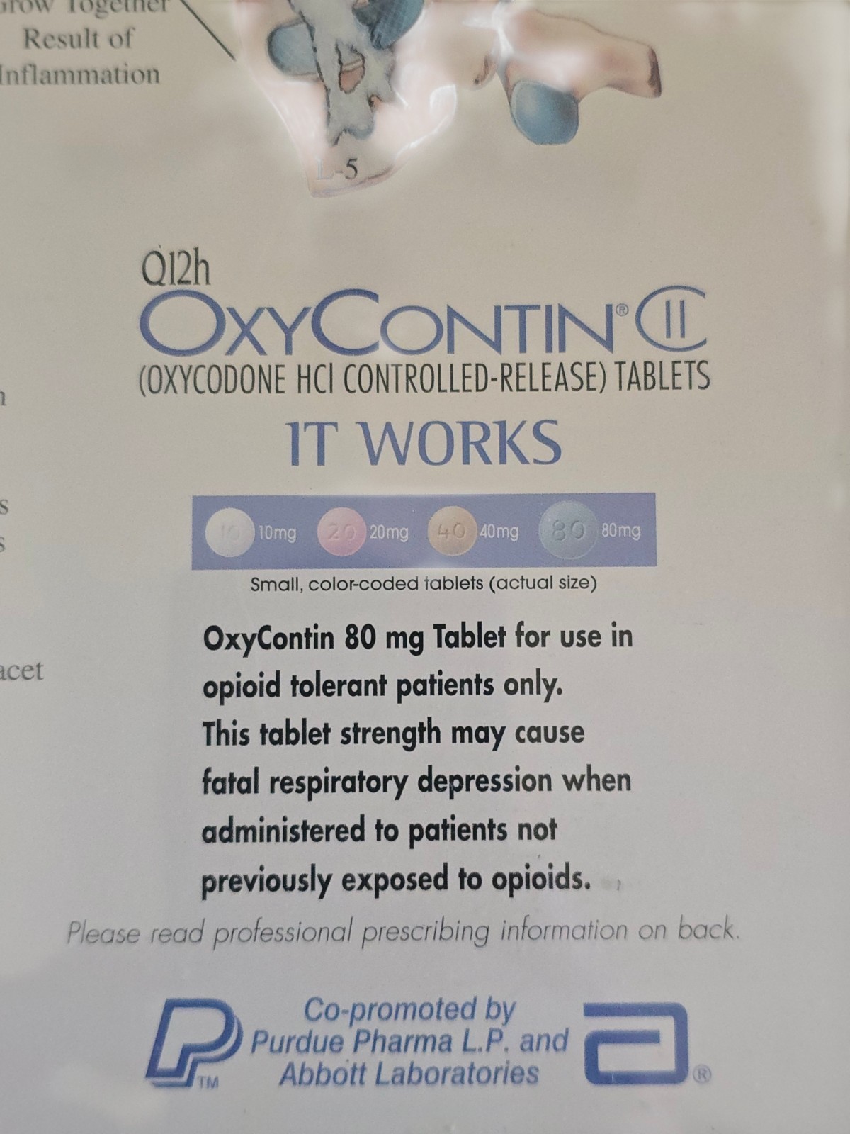 Purdue Pharma VIntage OxyContin Pharmaceutical Rep Collectible Poster