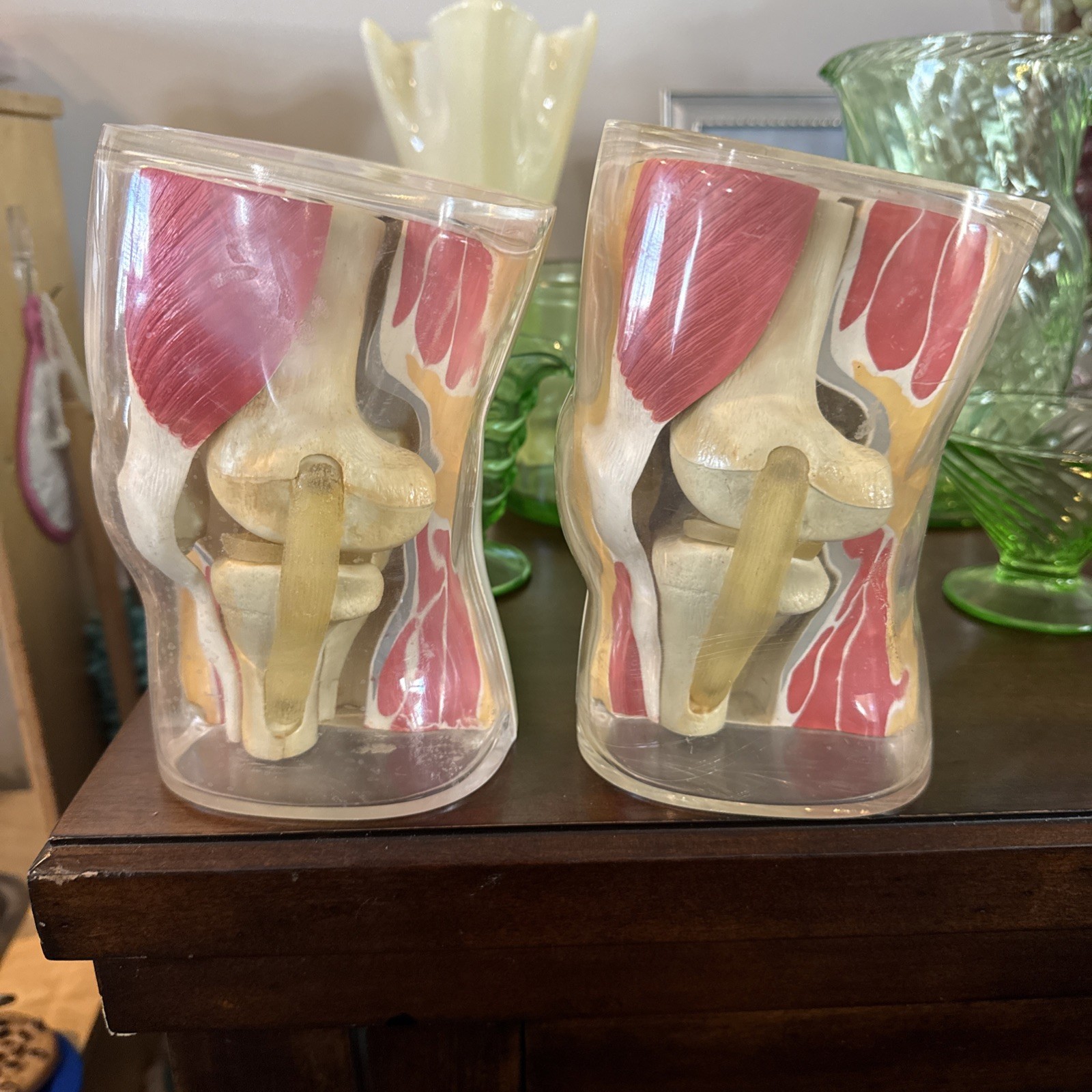 Vintage 1962 Human Knee Merck & Co Medical Anatomical Model Set Of 2 One Price