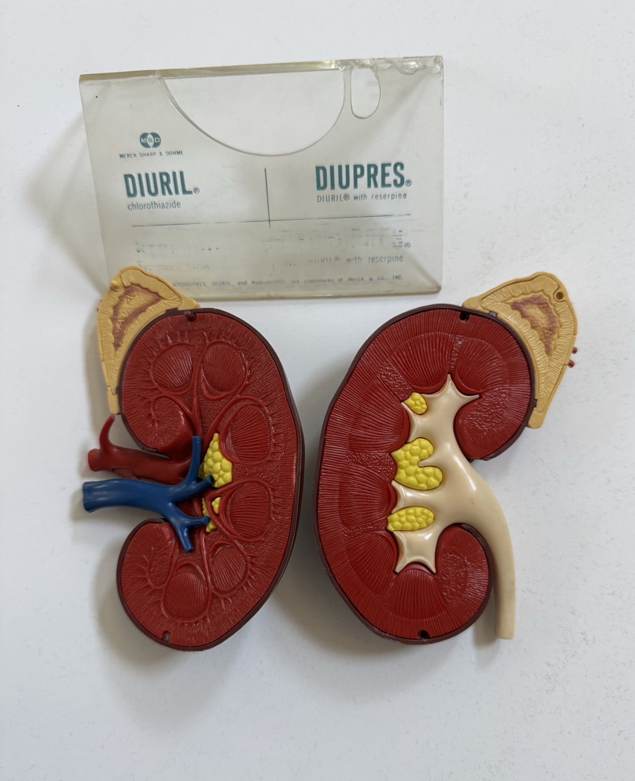 Vintage Merck Sharp & Dohme Models Kidney & Artery (DIURIL)