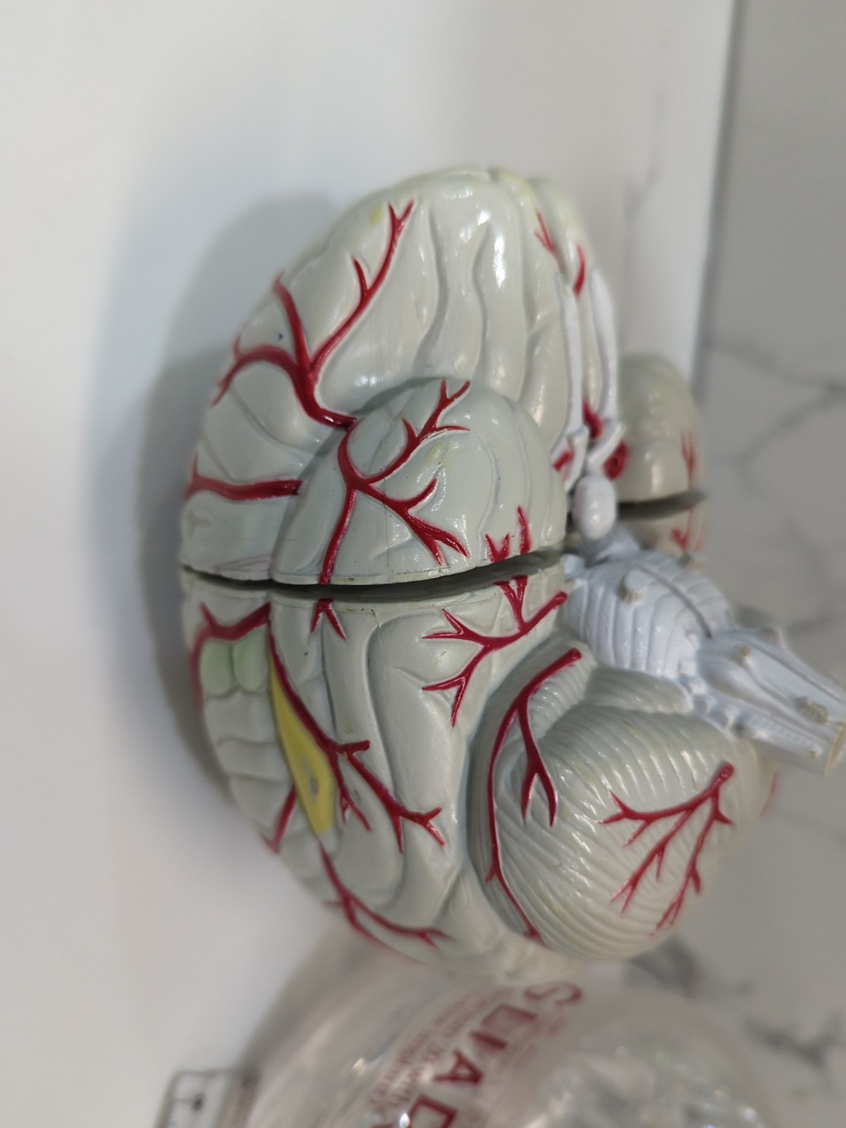 Gliadel Human Brain Anatomy Model w/ Clear Skull PharmaDesign Medical Display