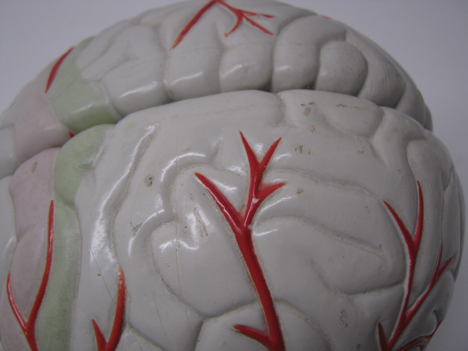 Seroquel Human Brain Anatomy Model w/ Clear Skull PharmaDesign Medical Display