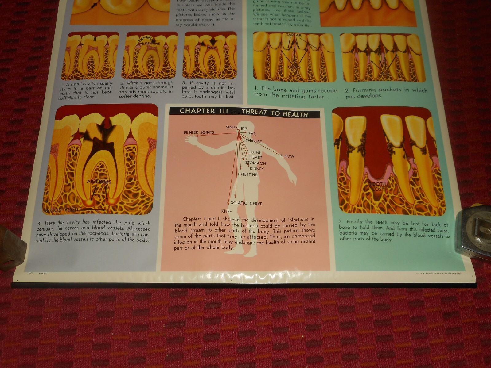 Vintage ANACIN Tablets WHITEHALL Laboratories ADVERTISING Dentist DENTAL POSTER