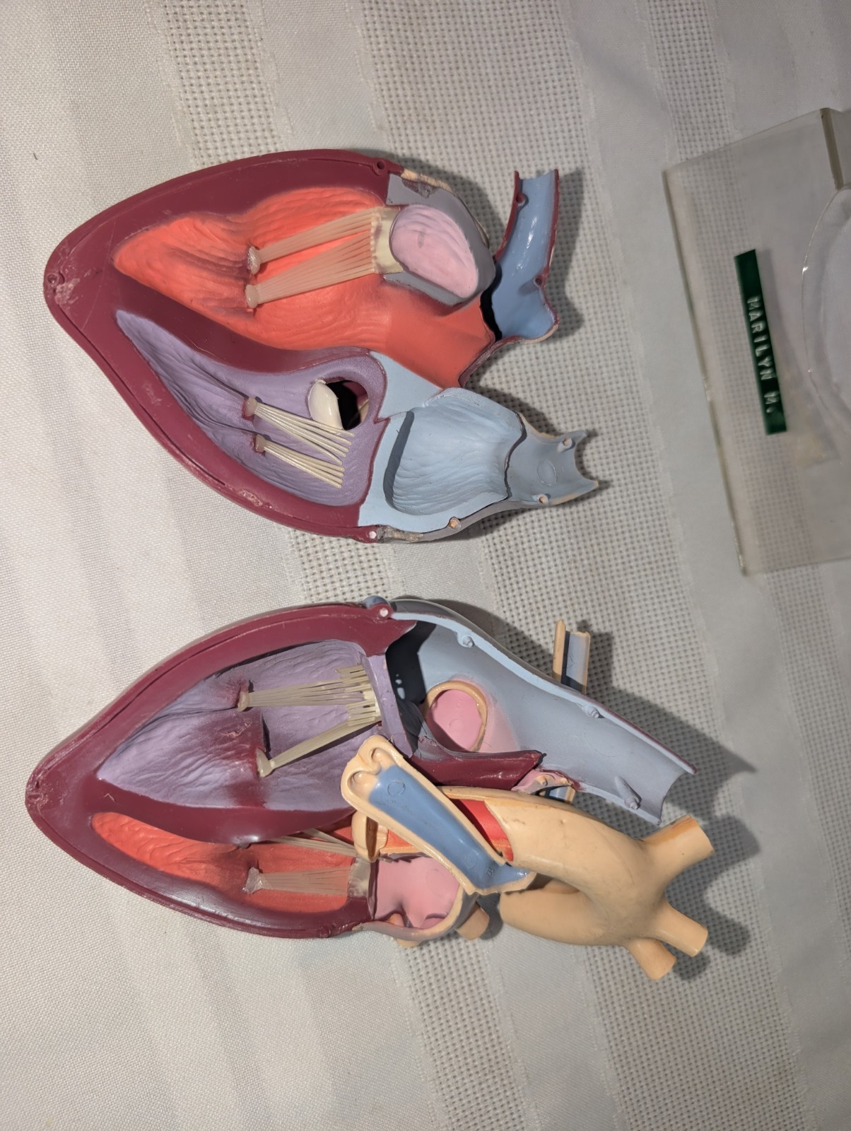 1960s Merck Pharmaceutical Advertising Model “Hydrodiuril Hydropres” Model