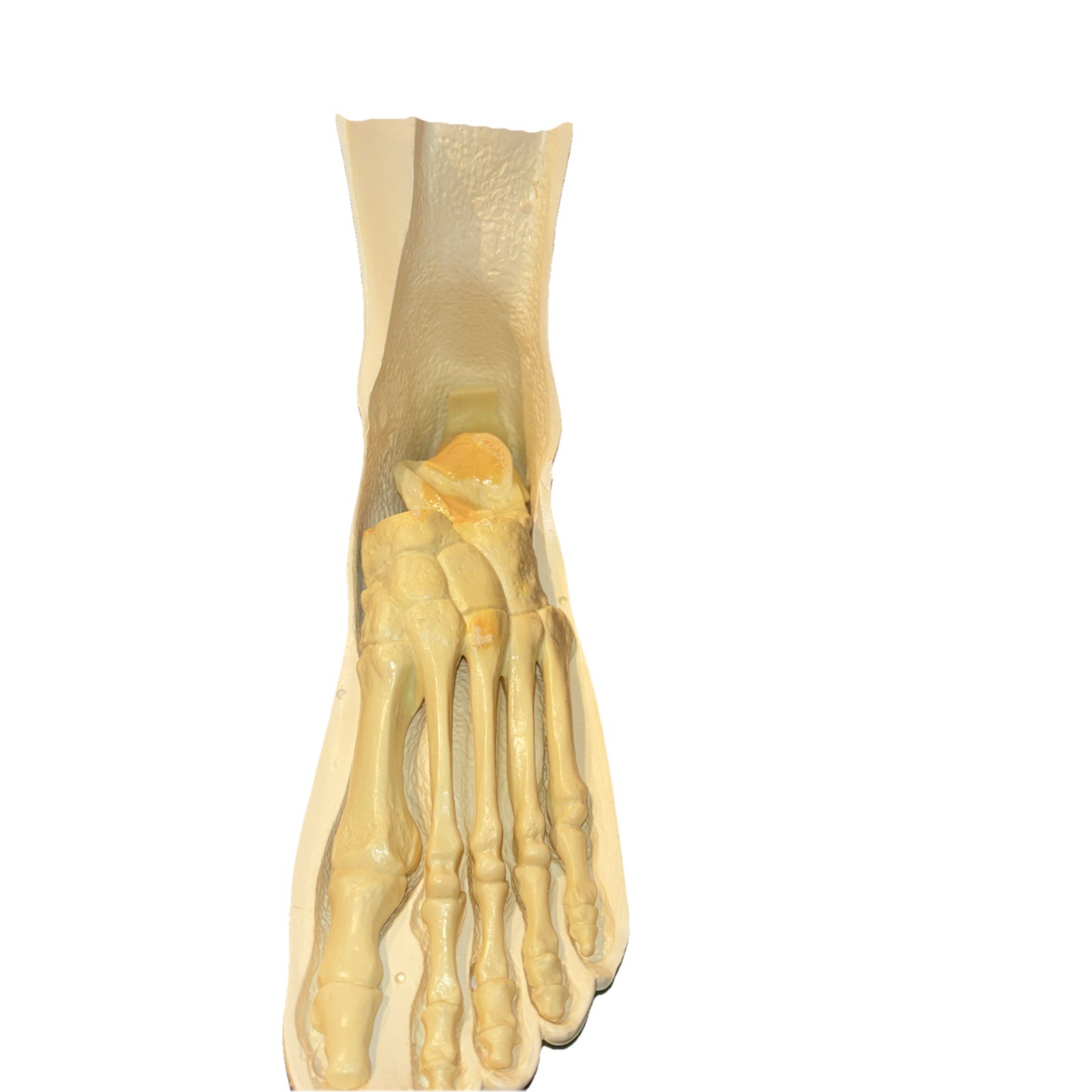Anatomical foot display – Merck, Sharp & Dohme, please read