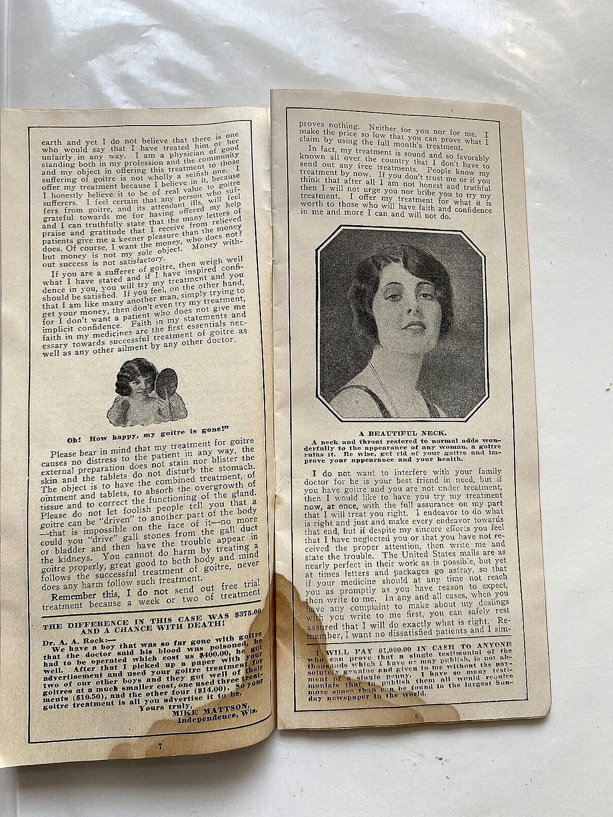 1932 Sales Literature for Goitre Cure. Dr. Arthur Rock, Milwaukee, Wisconsin.